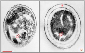 Nosema - brain, rabbit Nosema - brain, rabbit